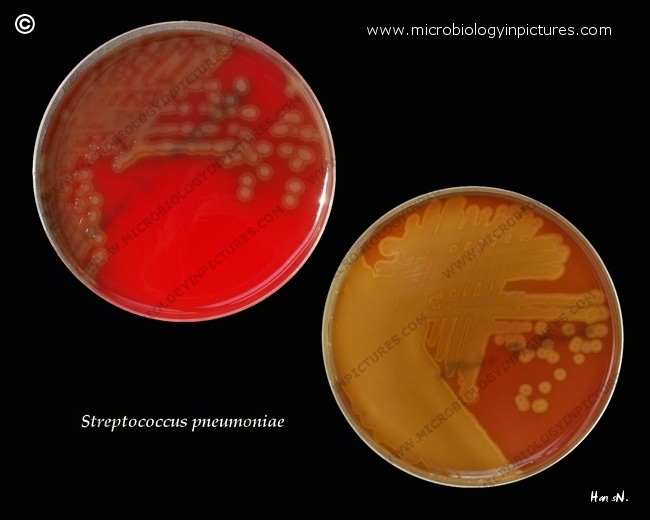 virulent and avirulent pneumococcus